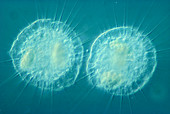 Light micrograph of protozoa Echinosphaer