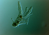 Light micrograph of protozoa Amoeba proteus
