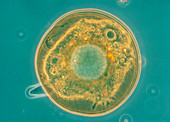LM of the shelled freshwater amoeba Arcella sp.p