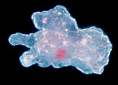 LM of amoeba proteus walking