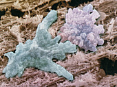 Coloured SEM: one Amoeba proteus engulfs another