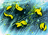 False-col SEM micro organisms Taxoplasma sp