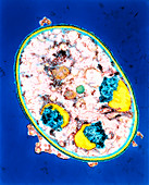 Coloured TEM of cyst of Pneumocystis carinii