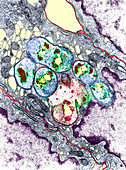 Intestinal protozoan parasites,TEM