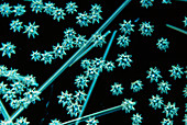 Light micrograph showing spicules of a sponge