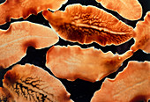 Light micrograph of liver fluke,Fasciola hepatica