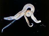 Light micrograph of male/female Schistosoma bovis