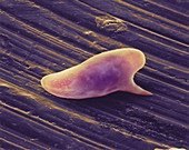 Coloured SEM of Schistosoma mansoni parasite egg