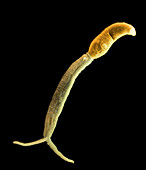 Coloured SEM of a schistosome parasite cercaria