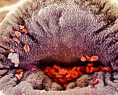 Coloured SEM of mouth of schistosome parasite