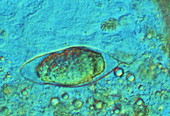 Schistosome egg