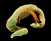 Mating schistosome flukes,SEM