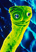 SEM of tapeworm taenia saginata