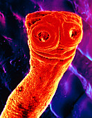 SEM of the beef tapeworm,