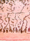 Tapeworm proglottid,light micrograph