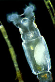 LM of common rotifer Philodina sp