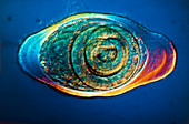 Light micrograph of Trichinella spiralis,larva
