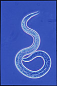LM of 1st larval stage of dog roundworm