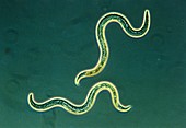 LM of Toxocara canis (dog roundworms)