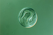 Embryo,Toxascaris leonina,x130,blue background