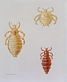 illustration showing 3 types of human louse