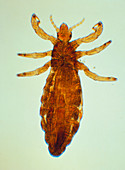 LM of human head louse
