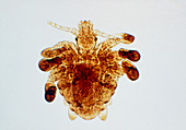 Light micrograph of Phthirus pubis,the crab louse
