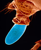 SEM of a fruit fly laying an egg
