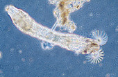 Black fly larva,light micrograph