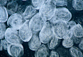 Black fly eggs,light micrograph
