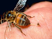 Honeybee,Apis mellifera,stinging a human finger