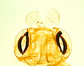 LM of chewing mouthparts of the silkworm