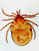 Light micrograph of the tick Ixodes sp