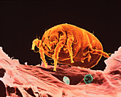 SEM of a dust mite on dandruff