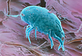 SEM of a dust mite