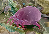 Dust mite,SEM