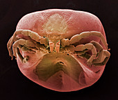 Common sheep tick,SEM