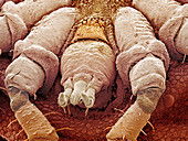 Sheep tick,SEM