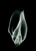 X-ray of an unidentified whelk shell