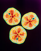 Coloured X-ray of three sand dollar shells