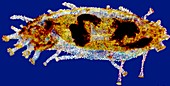 Holothuria sea cucumber,light micrograph