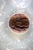 Cleavage in frog egg,light micrograph