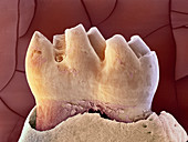 Mouse tooth,SEM