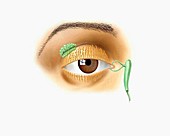 The eye lacrematal system