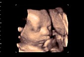 29 week old foetus, 4D ultrasound scan