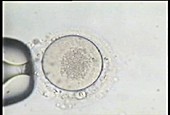 IVF