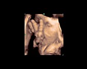 Foetus sucking thumb, 4D ultrasound scan