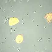 Neutrophils phagocytosing bacteria