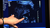 Pregnant woman ultrasound