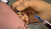 Doctor's hands taking blood from patient